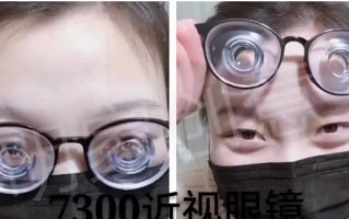 酒瓶底眼镜是多少度，酒瓶底眼镜是多少度数的