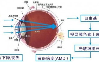 如何测试眼睛度数，如何测试眼睛度数？